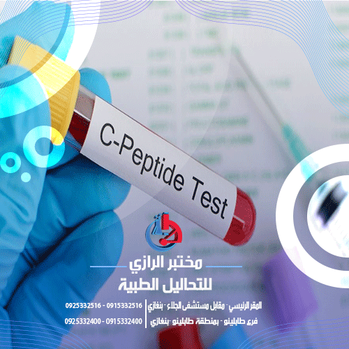 تحليل C-Peptide