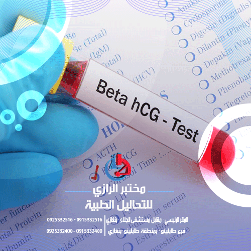 تحليل B-HCG