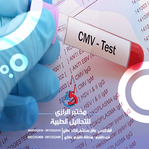 تحليل CMV