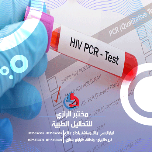 تحليل لكشف عن الإصابة بفيروس نقص المناعة البشري