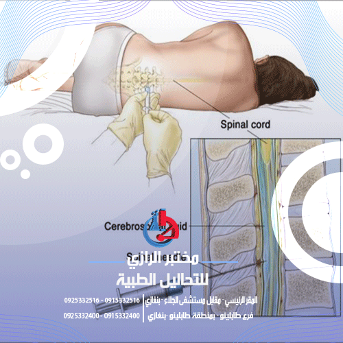 إختبار تحليل سائل الدماغي النخاعي (c.s.f.)